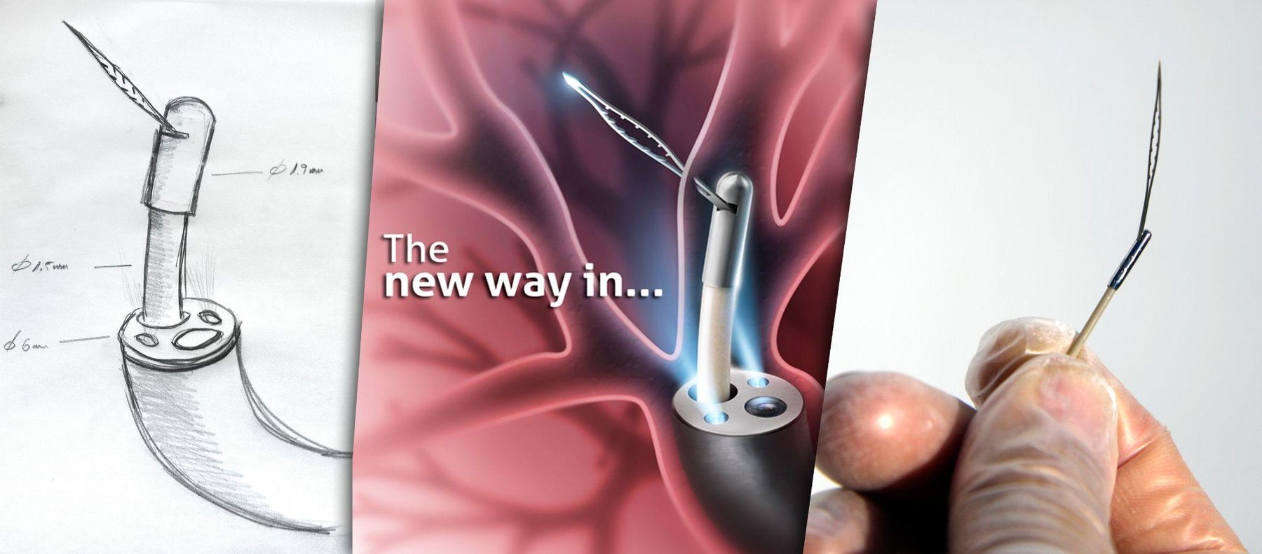 Arch Medical device